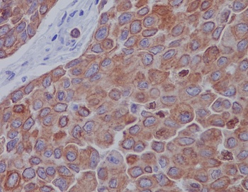 Mitofusin 2 MFN2 Rabbit Monoclonal Antibody