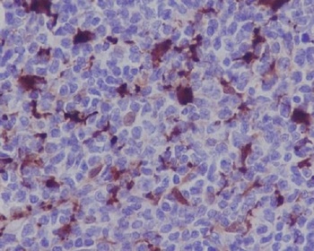 MERTK/Mer Rabbit Monoclonal Antibody