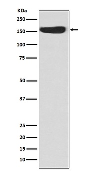CD163 Rabbit Monoclonal Antibody