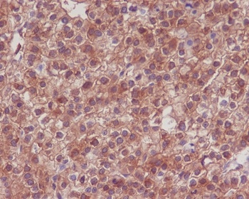 Hsp90 alpha + beta HSP90AA1 Rabbit Monoclonal Antibody