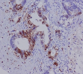 S100A4 Rabbit Monoclonal Antibody