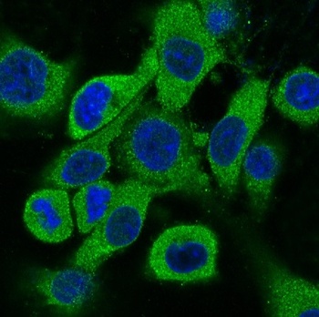 Cytokeratin 18 Krt18 Rabbit Monoclonal Antibody