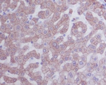 Cytokeratin 8 KRT8 Rabbit Monoclonal Antibody