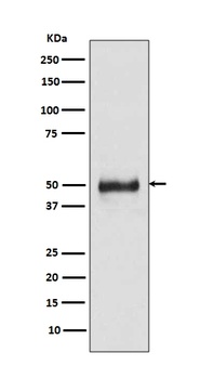 Cytokeratin 8 KRT8 Rabbit Monoclonal Antibody
