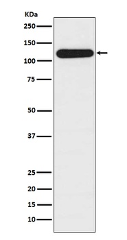 BubR1 BUB1B Rabbit Monoclonal Antibody