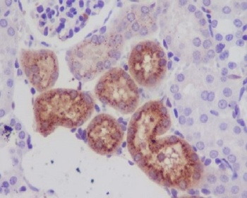 Lysozyme LYZ Rabbit Monoclonal Antibody