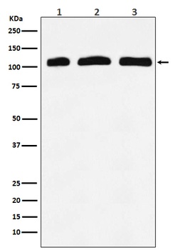PI 3 Kinase p110 delta PIK3CD Rabbit Monoclonal Antibody