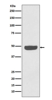 NSE ENO2 Rabbit Monoclonal Antibody