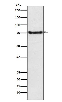 BDKRB2 Monoclonal Antibody