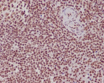 FUBP1 Rabbit Monoclonal Antibody
