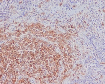 SHIP INPP5D Rabbit Monoclonal Antibody