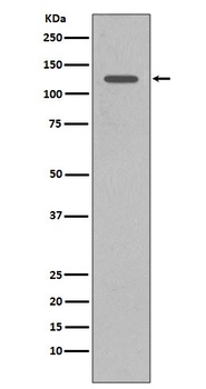 SHIP INPP5D Rabbit Monoclonal Antibody