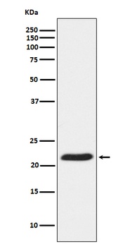 TCTP Rabbit Monoclonal Antibody