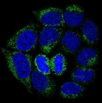 Bad Rabbit Monoclonal Antibody