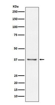 CD23 FCER2 Monoclonal Antibody