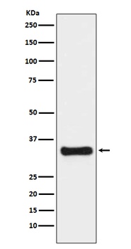 Thymidylate Synthase TYMS Monoclonal Antibody