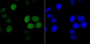 Histone H1.2 Monoclonal Antibody