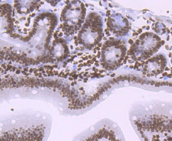 Histone H1.2 Monoclonal Antibody