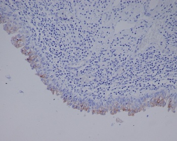 Uroplakin3a UPK3A Monoclonal Antibody