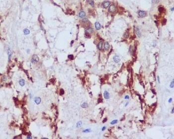 PI 3 Kinase p55 gamma PIK3R3 Rabbit Monoclonal Antibody