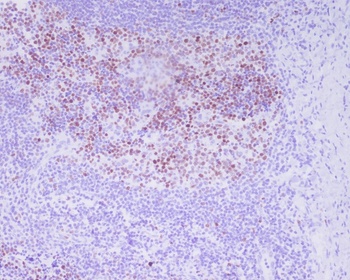 Phospho-Histone H3 (T3) H3F3A Monoclonal Antibody