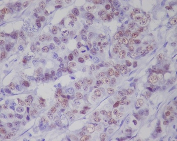 Phospho-p53 (S392) TP53 Rabbit Monoclonal Antibody