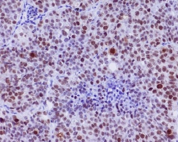Phospho-c-Myc (S62) Rabbit Monoclonal Antibody