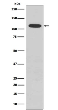 Phospho-Rb (S807) RB1 Rabbit Monoclonal Antibody