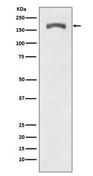 Phospho-PDGF Receptor beta (Y740) PDGFRB Rabbit Monoclonal Antibody