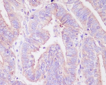 Phospho-FoxO3a (S253) Rabbit Monoclonal Antibody
