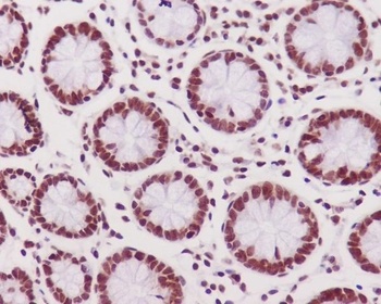 Phospho-DNA PKcs (S2056) PRKDC Rabbit Monoclonal Antibody