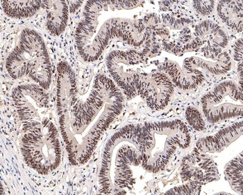 Phospho-DNA PKcs (S2056) PRKDC Rabbit Monoclonal Antibody