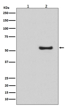 Phospho-Smad1/5/9 (S463/S465/S467) Rabbit Monoclonal Antibody