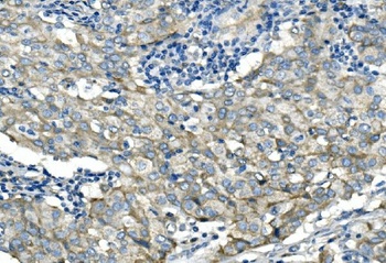 Desmoglein 2/DSG2 Antibody