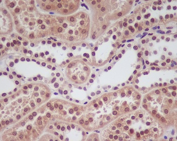 HIF-1 alpha Rabbit Monoclonal Antibody