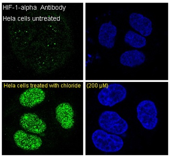 HIF-1 alpha Rabbit Monoclonal Antibody