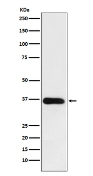 HSD11B1 Rabbit Monoclonal Antibody