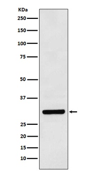 Bcl10 Rabbit Monoclonal Antibody