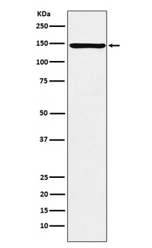 ORP150 Rabbit Monoclonal Antibody