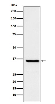GSTO1 Rabbit Monoclonal Antibody
