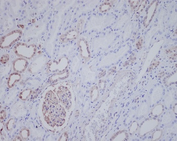 ALK Rabbit Monoclonal Antibody