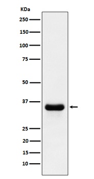 PSMD14 Rabbit Monoclonal Antibody