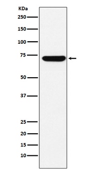 ZBTB7A Rabbit Monoclonal Antibody