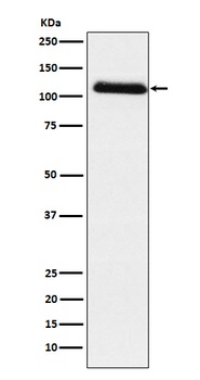 Fibrinogen alpha chain Rabbit Monoclonal Antibody