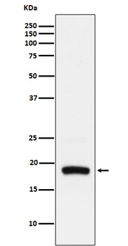 ARF5 Rabbit Monoclonal Antibody