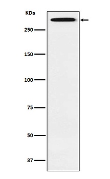 Smg1 Rabbit Monoclonal Antibody