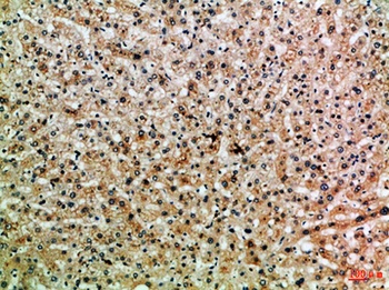 ASPP1 rabbit pAb