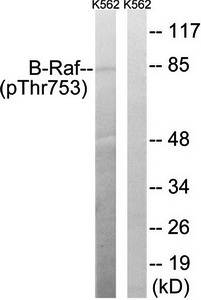 B-Raf (Phospho-Thr753) Antibody