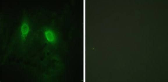 IKK-γ (Ab-85) Antibody