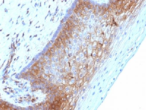 Beta-2 Microglobulin (Renal Failure & Tumor Marker) Antibody